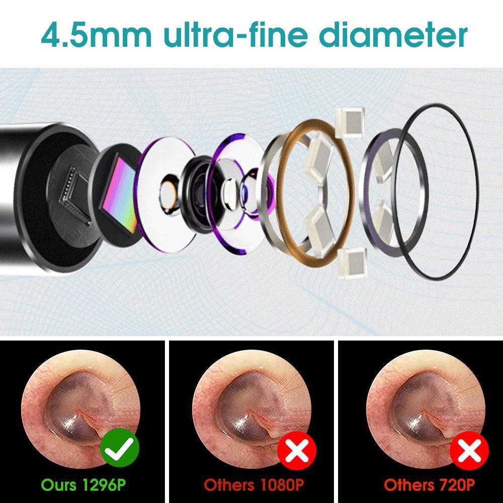 Wireless ear otoscope